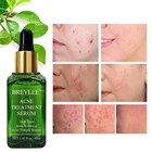 Экстракт листьев камелии синенсидской, лечение акне, Удаление прыщей, сыворотка для лица, увлажнение, восстановление кожи, уход за кожей, эссенция для лица с зеленым чаем и акне