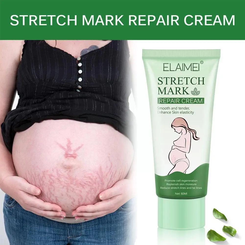 

New Remove Stretch Mark Cream Soothes Fat Lines Treatment Repair Cream Repair Wrinkle Growth Anti-Aging Body Maternal O8O7
