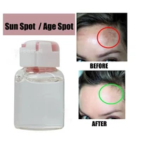 sun spot age spot brown spot dark spot removertreatment corrector no scam