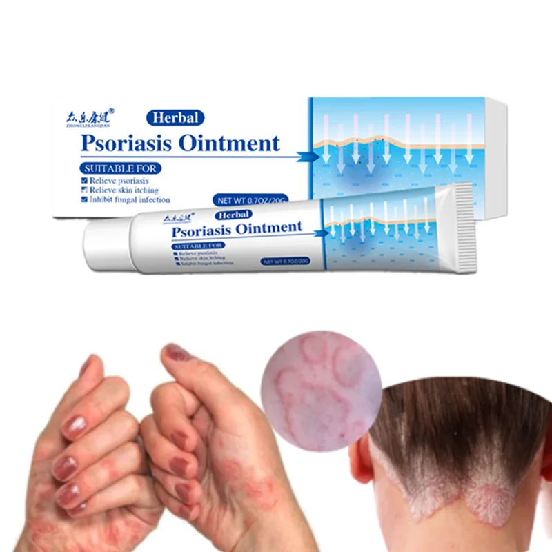 

New Psoriasis Cream Herbal Antibacterial Antipruritic Relief Eczema Rash Urticaria Desquamation Treatment Ointment Foot Cream