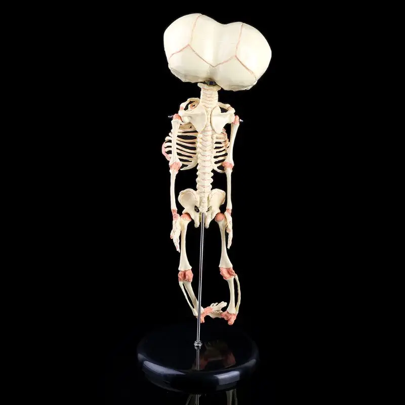 

Human Baby Deformed Head Skull Research Model Skeleton Anatomical Brain Anatomy Teaching Study Display