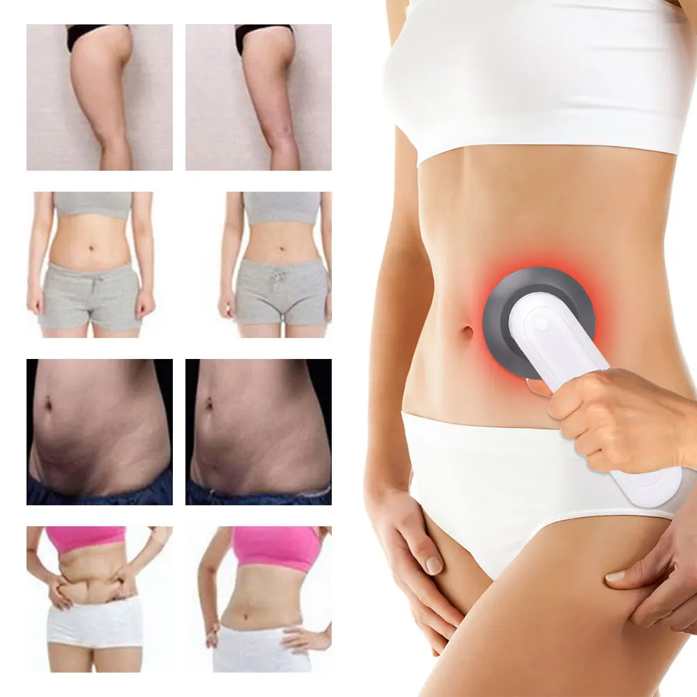 Ультразвуковое кавитационное косметическое устройство с ЖК-дисплеем 3 режима |