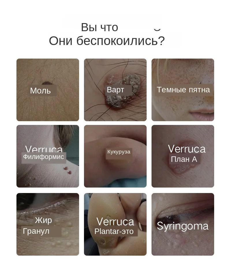 Плазменная ручка, Xpreen lcd Лазерная плазменная ручка машина средство для удаления бородавок моль машина для удаления татуировок кожа тег удаление пятен очиститель