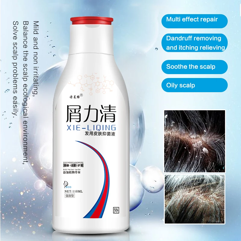 Горячий шампунь для ухода за волосами против перхоти сильный антипругический