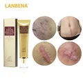 LANBENA черника сыворотка+ Гиалуроновая кислота сывороточная эссенция увлажняющая уменьшает тонкие линии отбеливание против старения морщин уход за кожей 2 шт