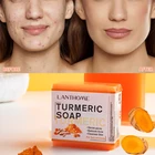 Мыло от акне, куркума, очищает кожу, удаляет клещей, сужает поры, для ванной, мыло ручной работы для натурального отбеливания кожи, противовоспалительное