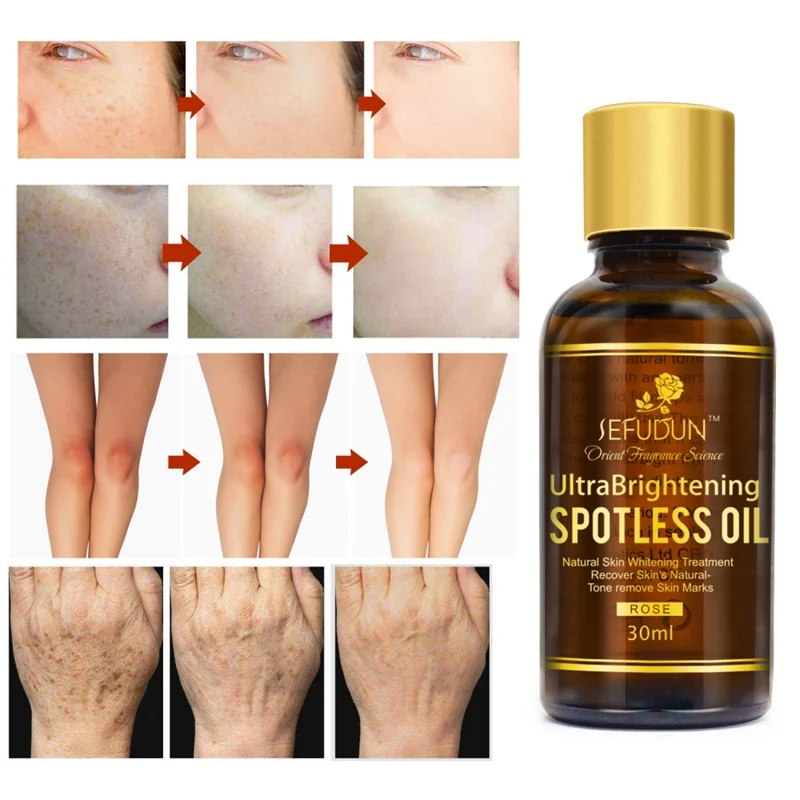 

Rose Whitening Facial Oil Moisturizing Lightening Pigment Anti-freckle Essential Oil