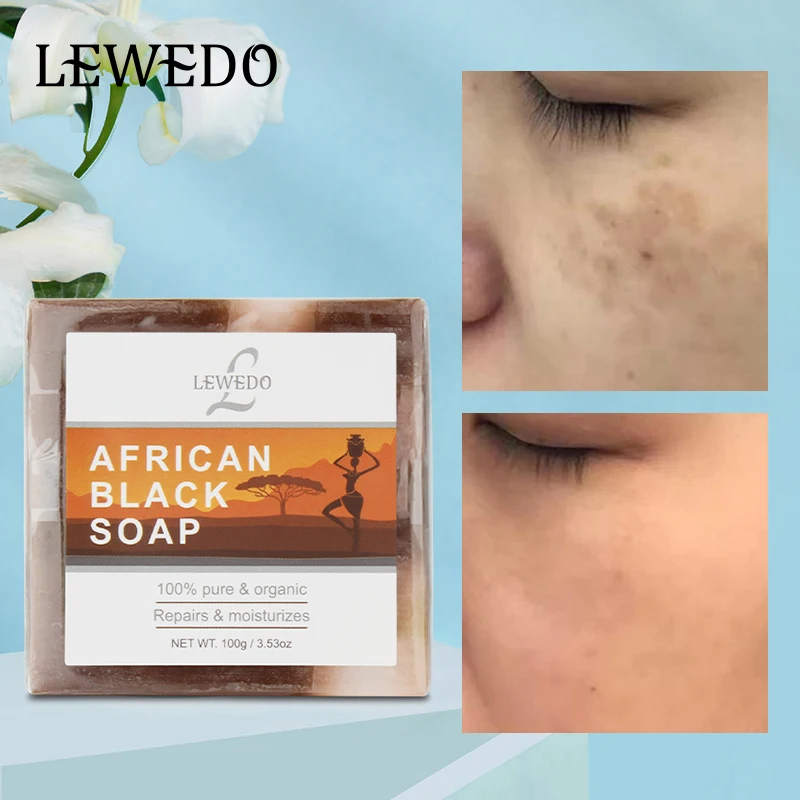 Africa Black Soap Deep Cleansing for Body Face Dark Black Skin Lightening Oil Control Anti-Acne Face Skin Care All Skin Types