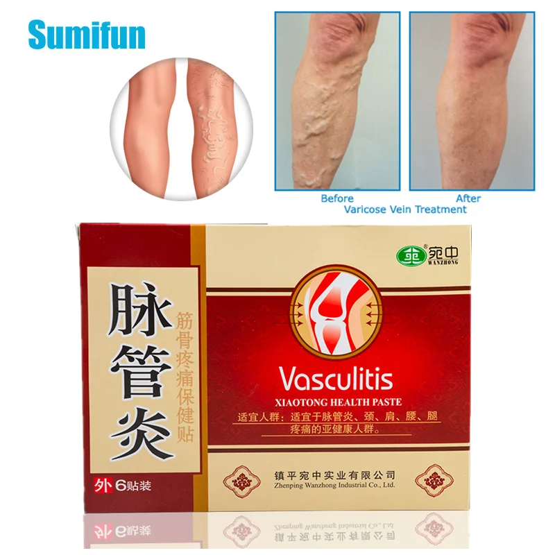 12 шт. = 2 коробки пластырь от варикозного расширения вен|Пластыри терапевтические|