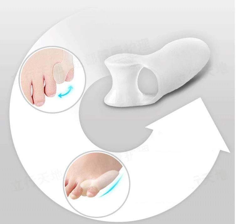Sumifun 10 шт. вальгусная деформация Bicyclic Bone Thumb ортопедические подтяжки для