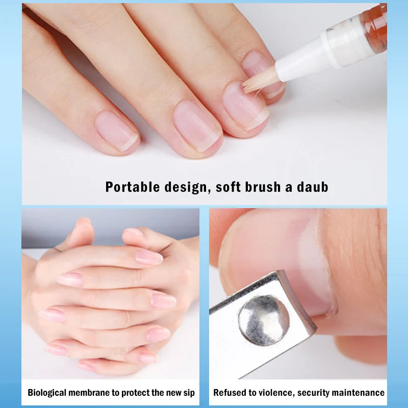 

Nourishment Oil Anti-fungal Nail Liquid Set Finger Toe Nail Fungus Care Liquid Pen Gentle Ingredients 4*3ML