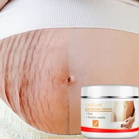 stretch marks maternity repair cream remove pregnancy scars acne cream anti aging anti winkles firming body creams skin care