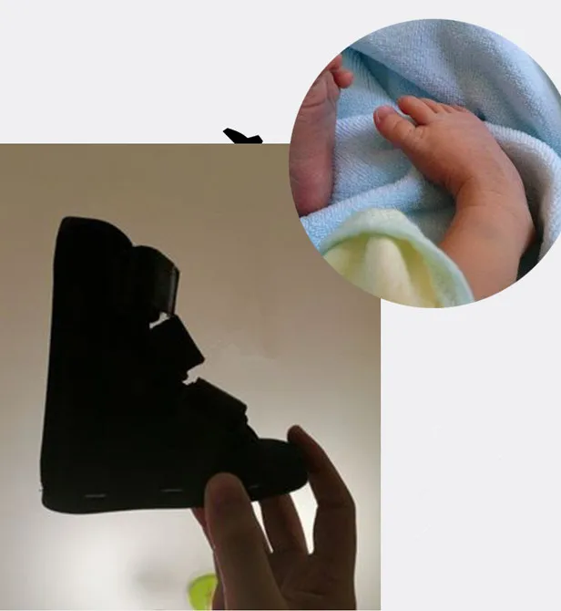 Kids AFO Drop Foot Splint Baby Ankle Brace Night Toddler Strephenopodia Strephexopodia | Красота и здоровье