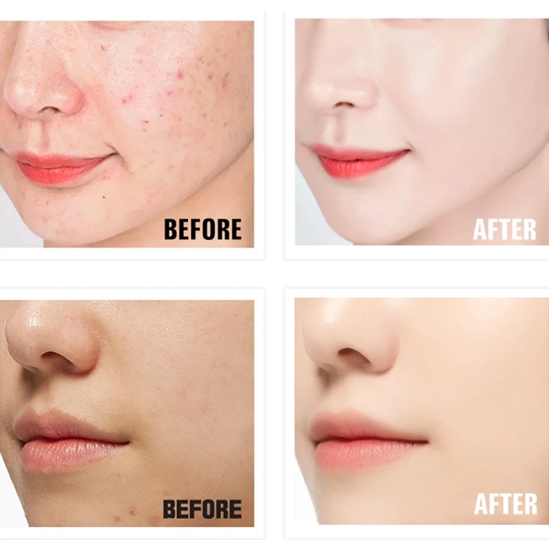 NOVO BB CC Крем Осветляющий жидкий консилер увлажняющий Сужающий поры Подушка крем