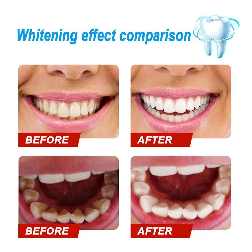 

Teeth Whitening Fruit Toothpaste Cleaning Hygiene Stain Dental Baking Soda Care Gums Press Bleeding Removal Oral Fight M2A3