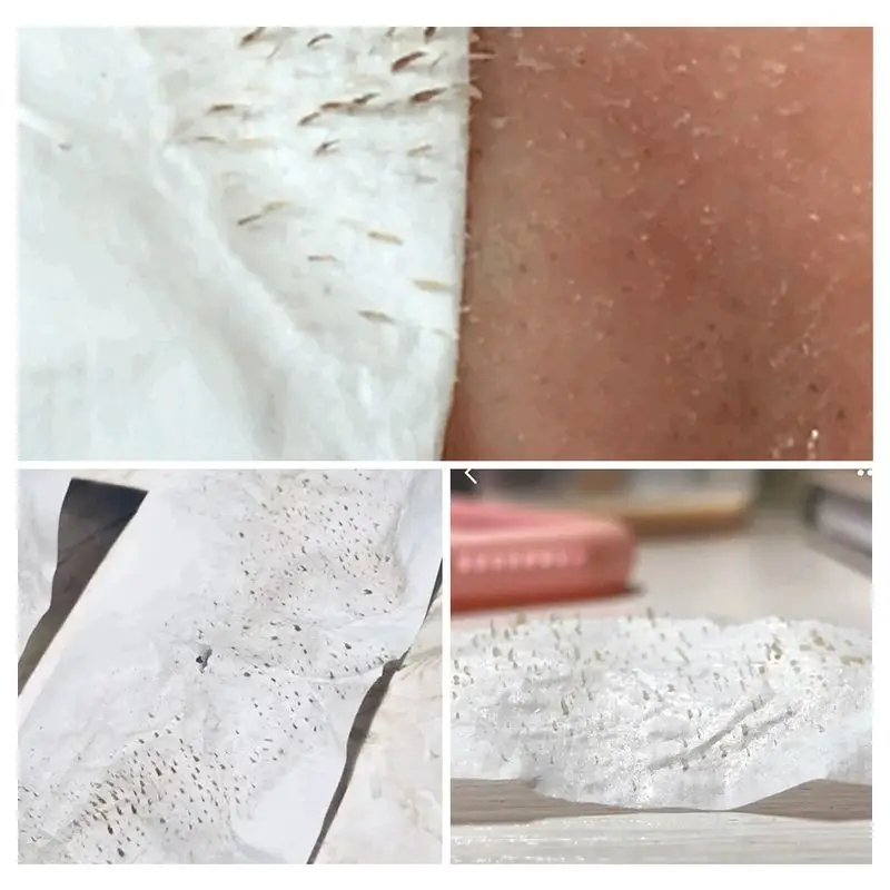 Натуральная Сыворотка для лица маска удаления черных точек эссенция очищения