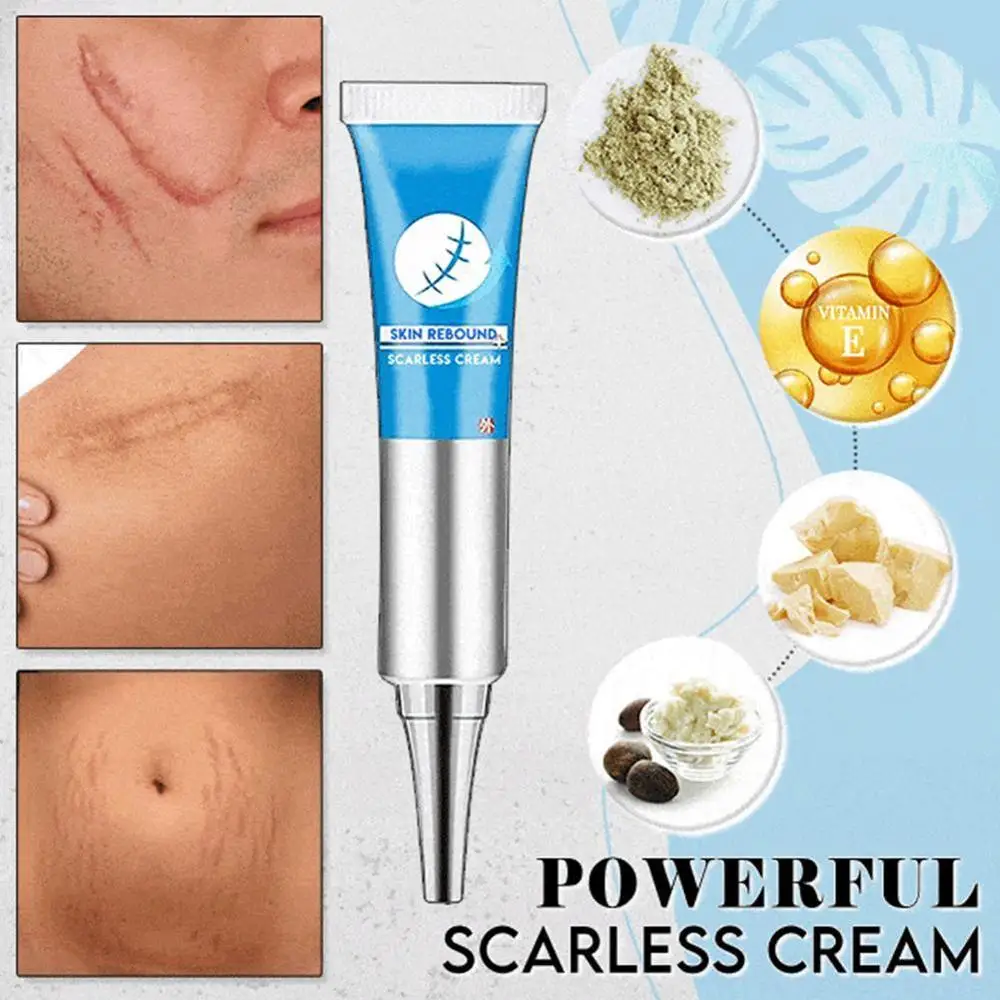Scar Repair Cream Acne Treatment Face Blackhead Repair Moisturizer Whitening Skin Pores Care Oil Control Gel Shrink Scar M0Z1