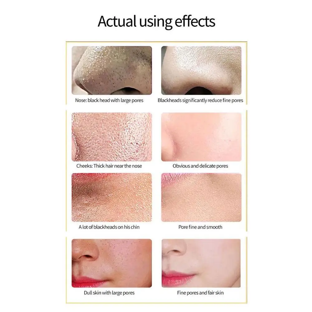 

15ML T-zone Care Oil-controlling Pore-shrinking Facial Serum, Deep Cleansing, Purifying Pores And Smoothing Skin