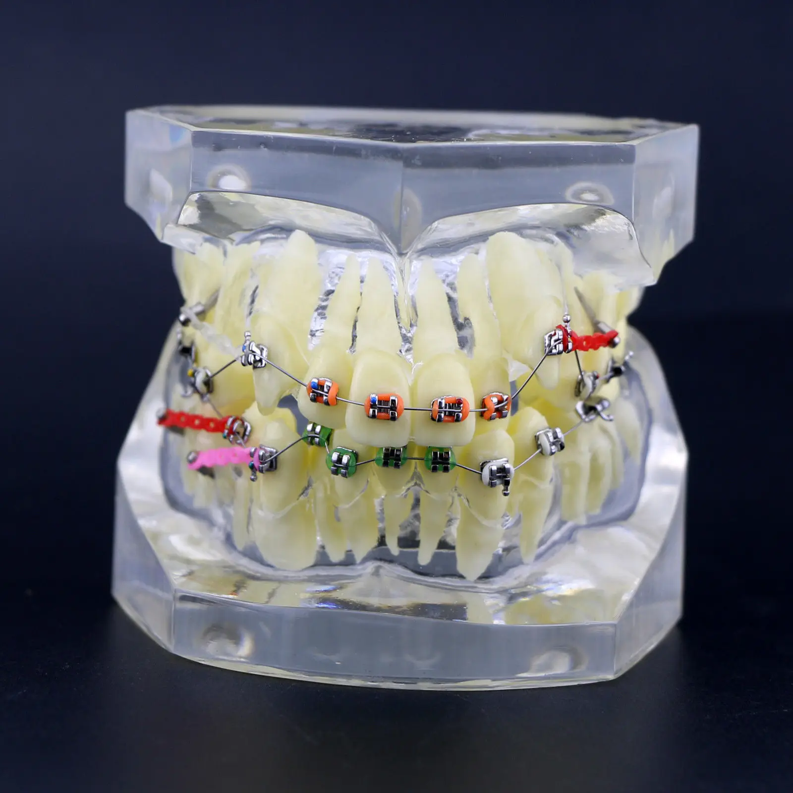 1 шт. Ортодонтическая зубная терапия модель прикуса с цепной проволокой #3005