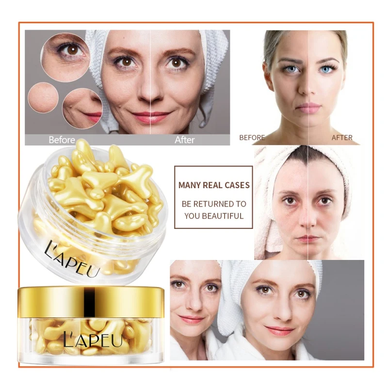 Sheep Placenta Gold Capsule Essence Hydrating Firming Skin Ant-wrinkle Anti-drying Face Serum | Красота и здоровье