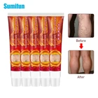 Мазь от варикозного расширения вен Sumifun паучьи ноги, D3176, 5 шт.