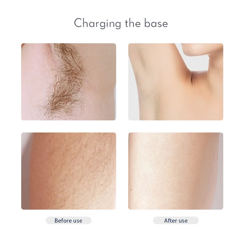 Мини перезаряжаемый эпилятор для женщин электрический бритва тела лица ног