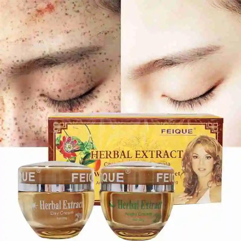 

Removing Spot Cream Beauty Cream Fade Melanin Freckle Removal Cosmetic Set Refining Nourishing Anti Makeup