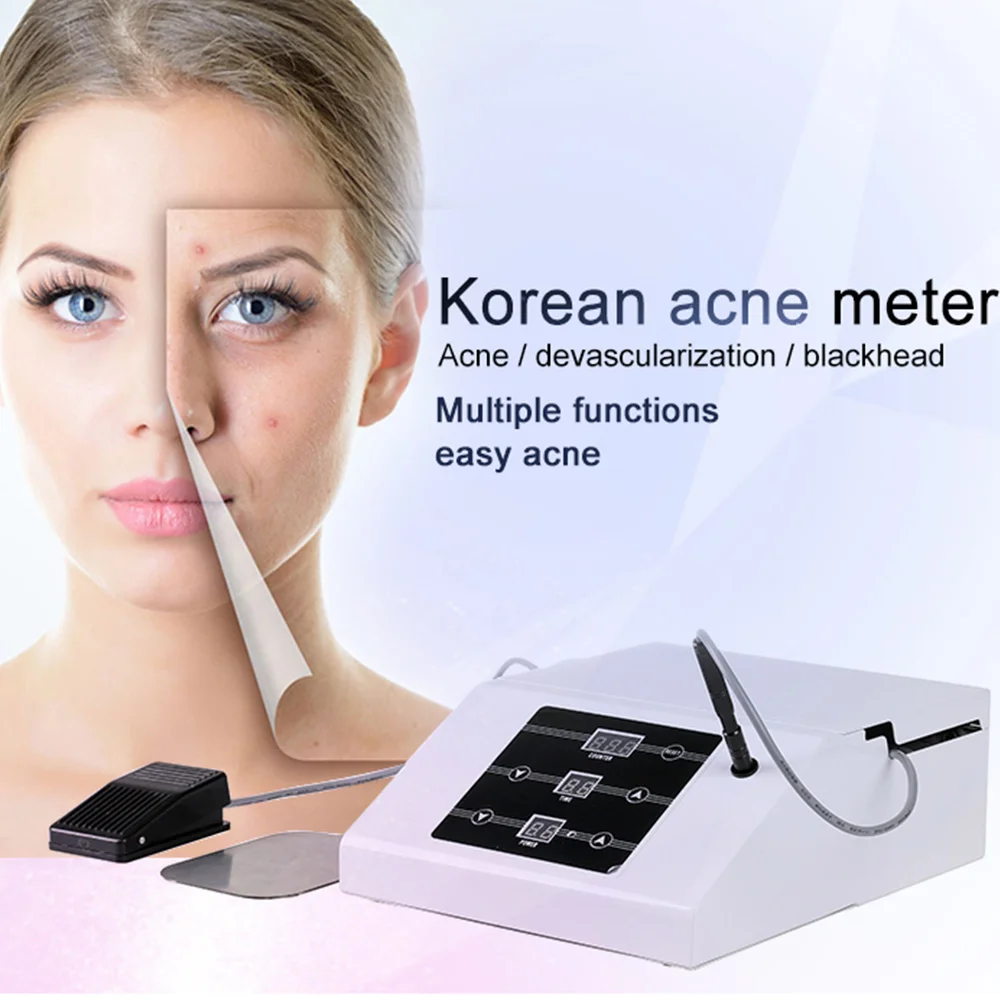 

Korean Ance Insulated RF Cysts Removal Dark Spot PimplesTreatment Acne Beauty Machine for Blackhead