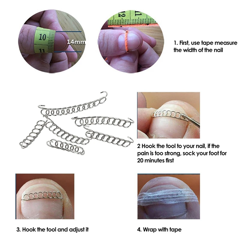 3 шт. педикюр из акрониксовой проволоки для коррекции вросших ногтей проволочный