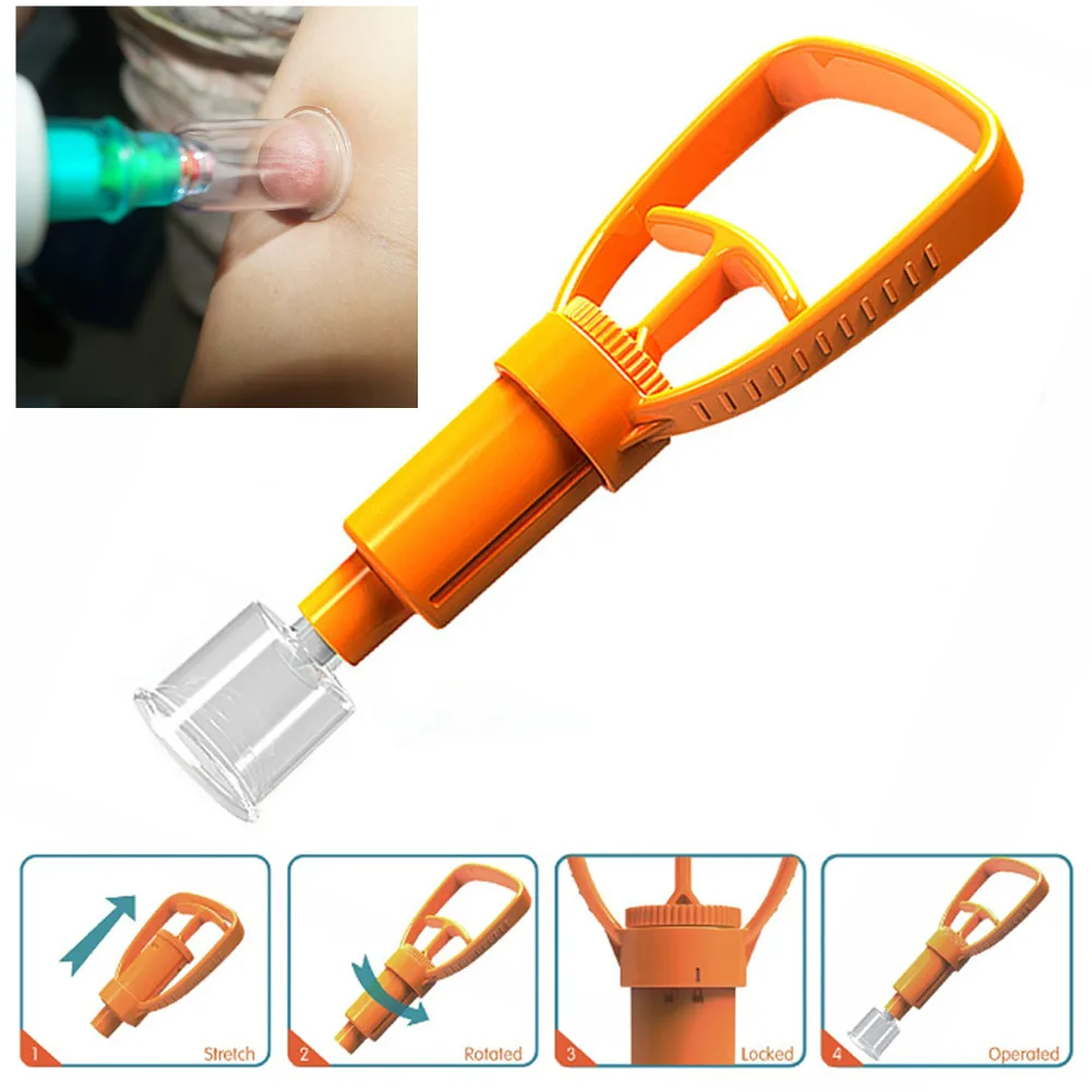 Экстрактор Venom спасательный инструмент для выживания на открытом воздухе