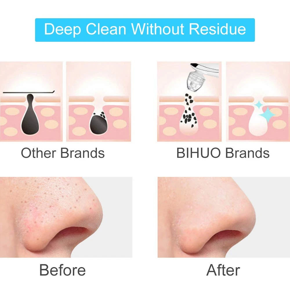 Хит продаж! Перезаряжаемый очищающий пор для удаления угрей Очищающий лица