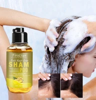 100ml ginger shampoo hair loss shampoo solid hair care anti hair loss anti dandruff shampoo hair growth treatment