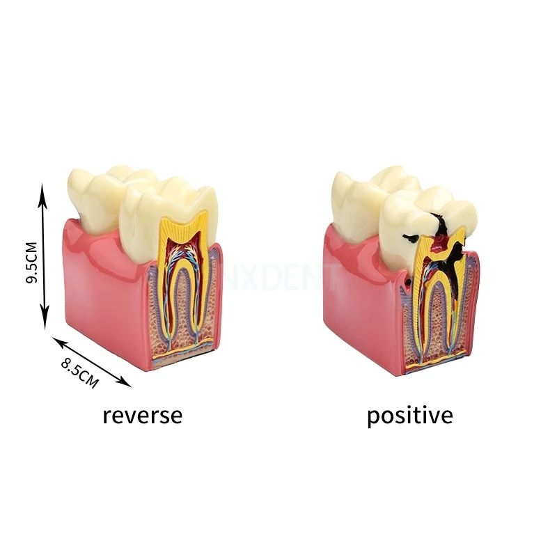 1 шт. карниз для зубов | Красота и здоровье
