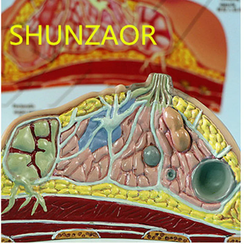 1:1 медианный отдел женской груди патологии анатомия модель комплекта настольная