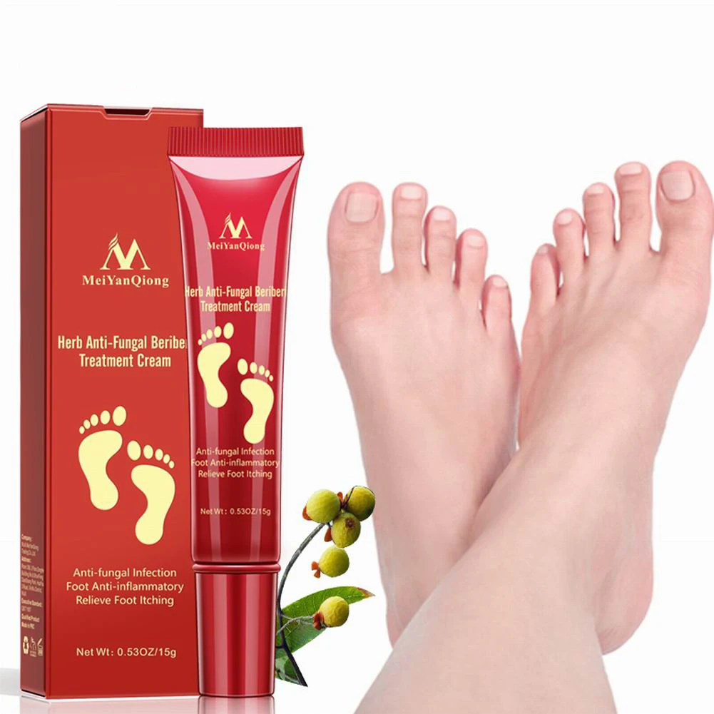 Foot травяной крем анти грибковая снять разъедание кожи для ног уход за кожей