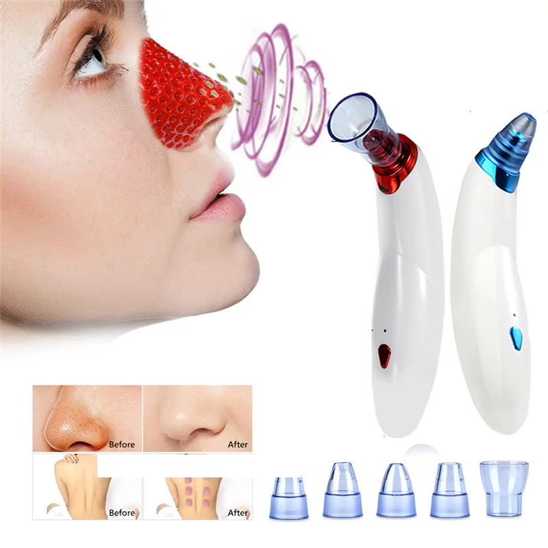 Медицинские банки для терапии тела удаления черных точек вакуумное всасывание