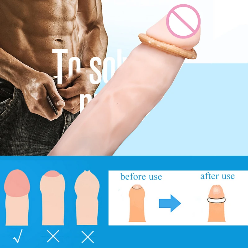 Секс магазин кольцо для пениса с задержкой времени многоразовое мужского шипами