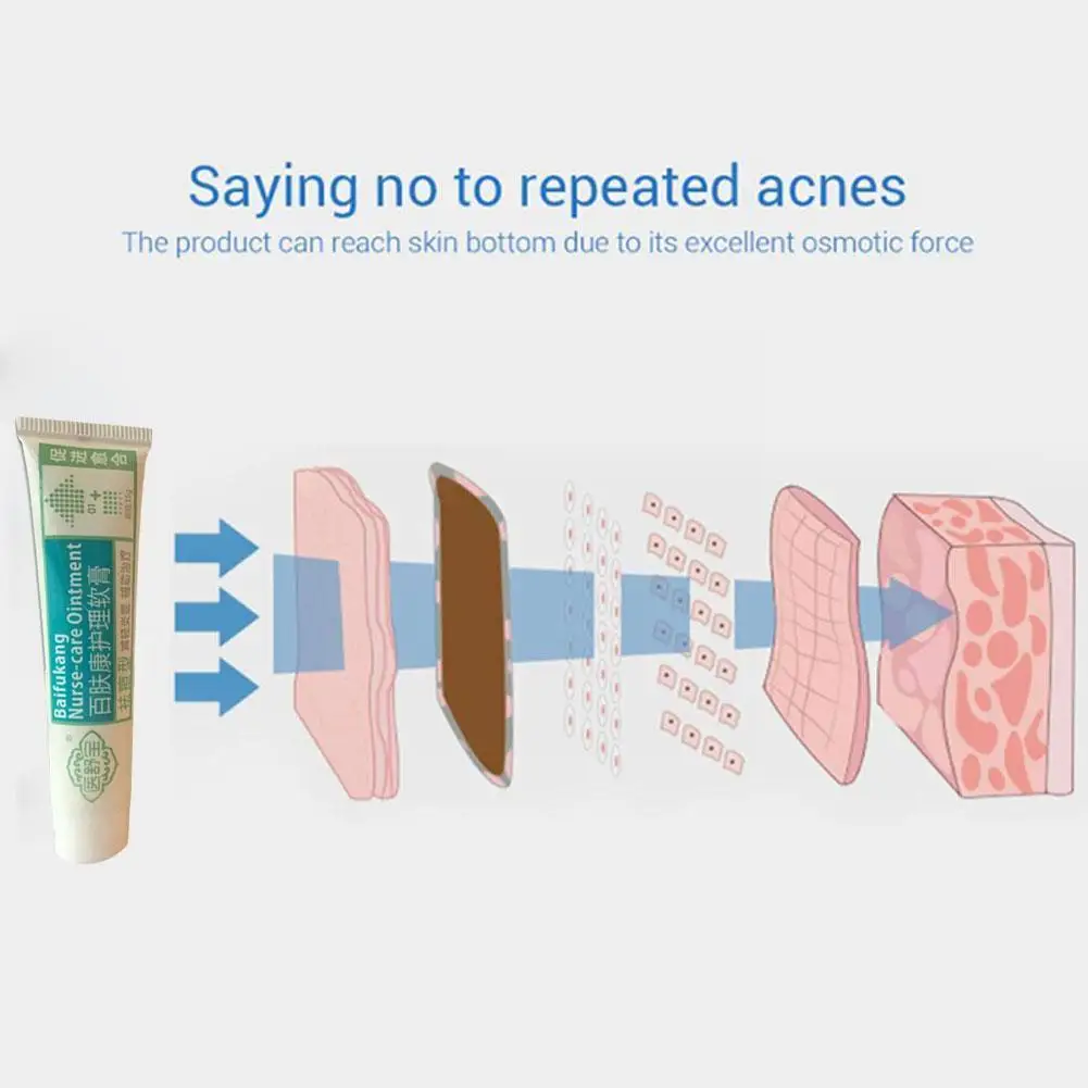 

Anti Acne Removal Cream Acne Treatment Shrink Pores Moisturizing Whitening Fade Acne Cream Spots Care Acne Oil Control Skin S0F2