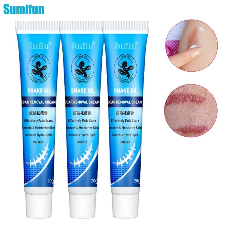 

3pcs Scar Cream Stretch Marks Remover Face Acne Scar Removal Cream Herbal Anti Removal Stretch Marks Acne Treatment Scar 30g