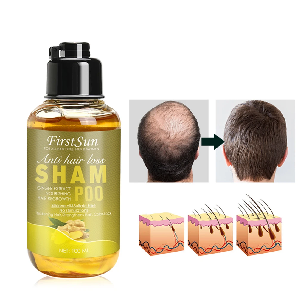 

Ginger Juice Hair Shampoo Professional Hair Scalp Treatment Oil Control Hair Growth Dense Anti Hair Loss Anti Itching 100ML