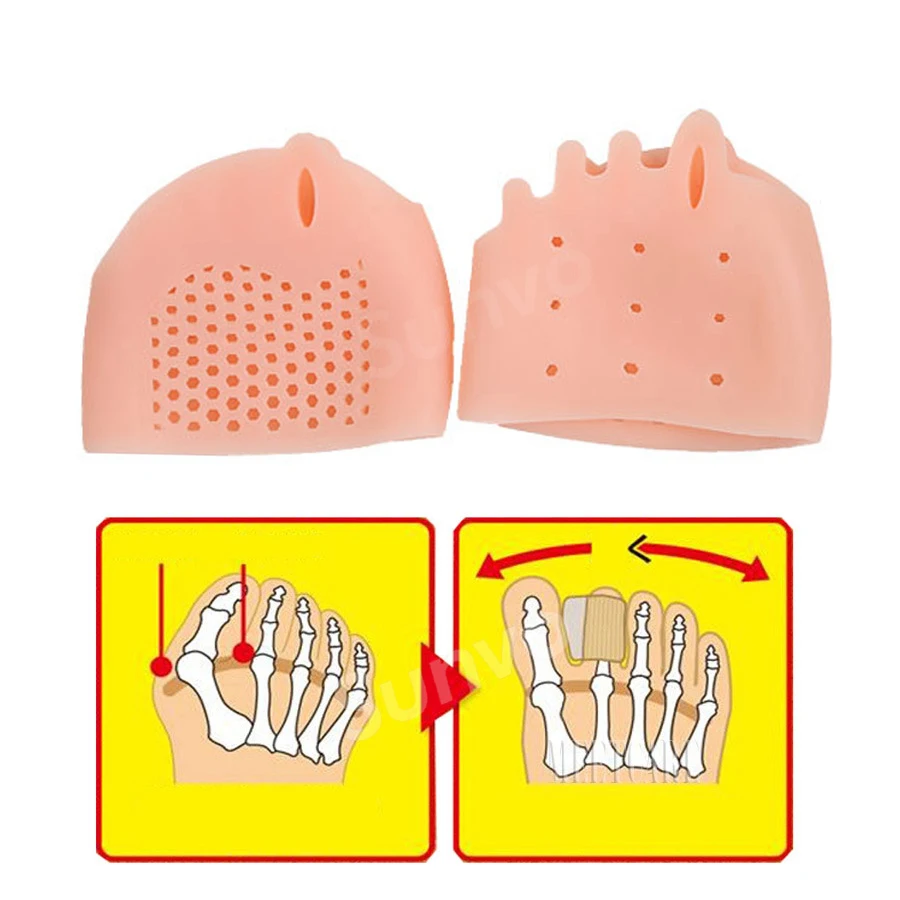 Вставки для вальгусной деформации при разделитель пяти пальцев силиконовые