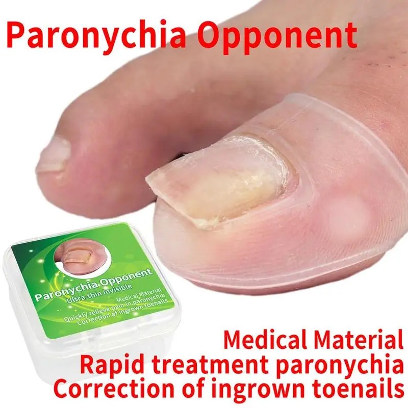 

Silicone Ingrown Toenail Correction Tool Invisible Tool Ingrown 2pc Straightening Nail Treatment Elastic Toe Pedicure Clip J5J5