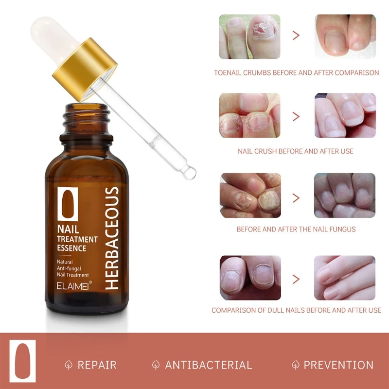 

Nail Treatments Hepbal Nourishing Fingernal Essence Hand Foot Whitening Toe Nails Fungus Removal 30ml