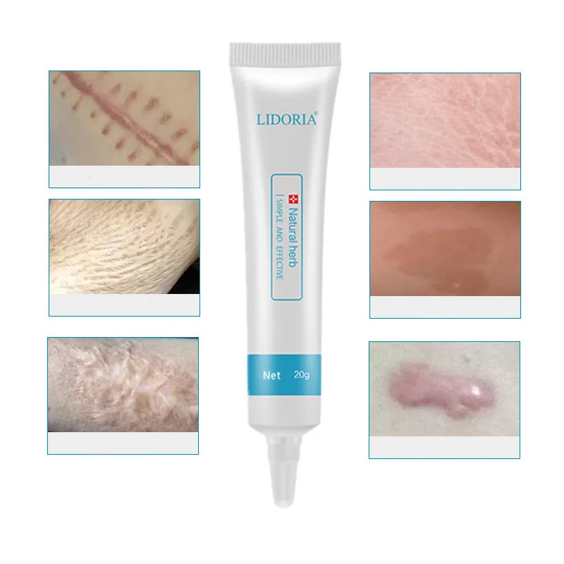 

20g Scar Removal Cream Face Cream For Body Acne Scar Stretch Marks Remover Cream Skin Repair Face Cream Acne Spots