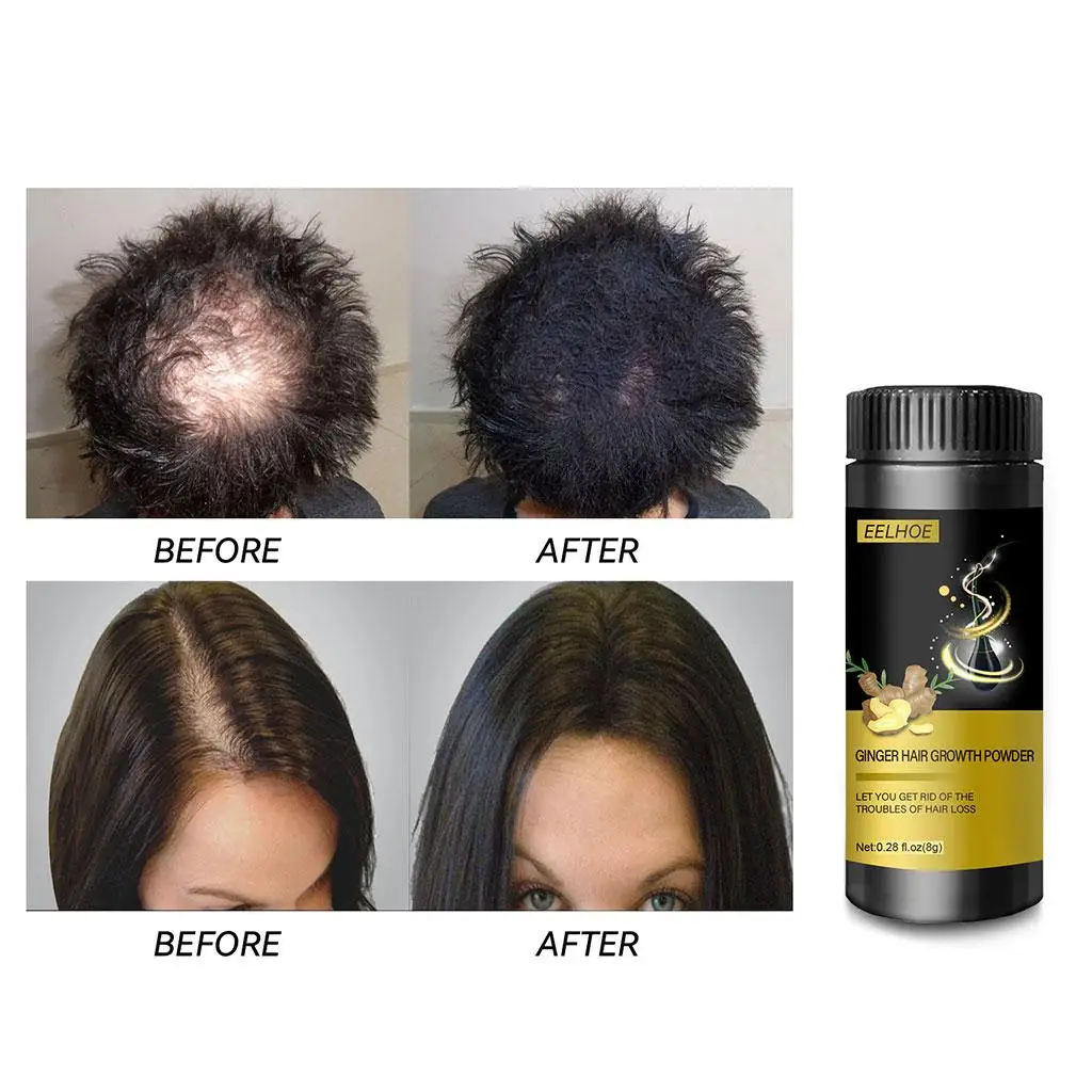 Ginger Hair Growth Powder Scalp Oil Control Promotes Thicker Care Essence for Prevent Thinning Dry Adults | Красота и здоровье