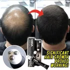 Сыворотка для роста волос, интенсивный роликовый массажер для волос с тройным роликом, быстрая восстановление линии волос, эссенция против выпадения волос