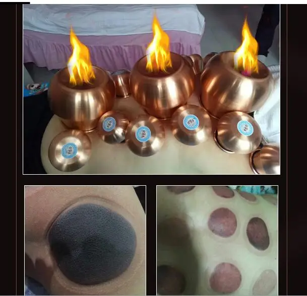 Монгольские банки для тушения огня 6 см * 5 два раза нагревающиеся красная медь