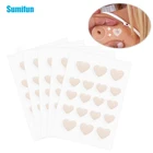 36 шт., пластырь для удаления бородавок и бородавок