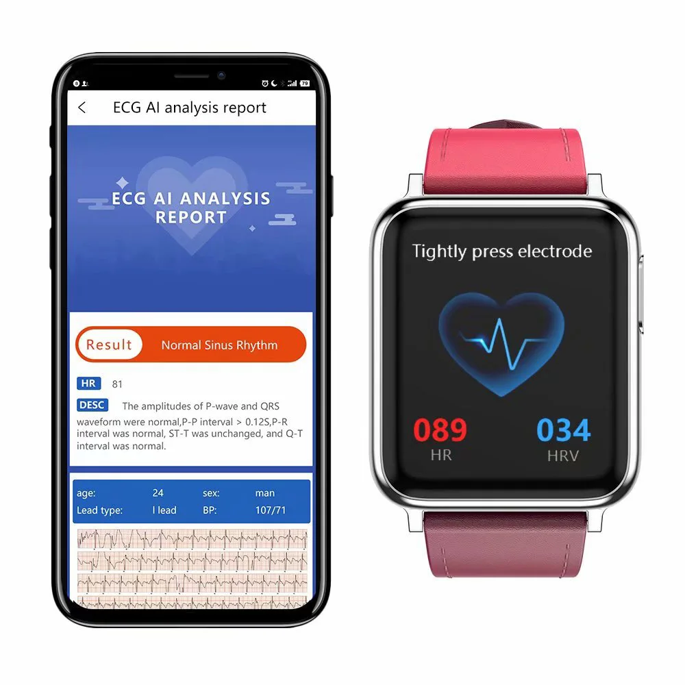 ECG PPG SPO2 Smart Band Watch Men Blood Pressure Oxygen Heart Rate Monitor Smartwatch Women Waterproof for Android IOS Xiaomi