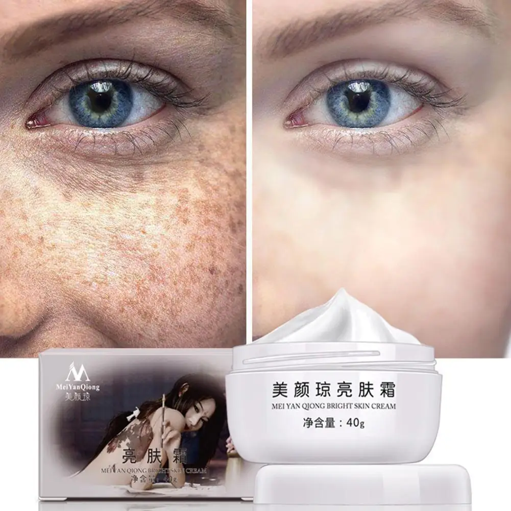 

Brightening Cream Beauty Moisturizing Lighter Cream Whitening Fading Freckle Remove Melasma Acne Pigment I8W9